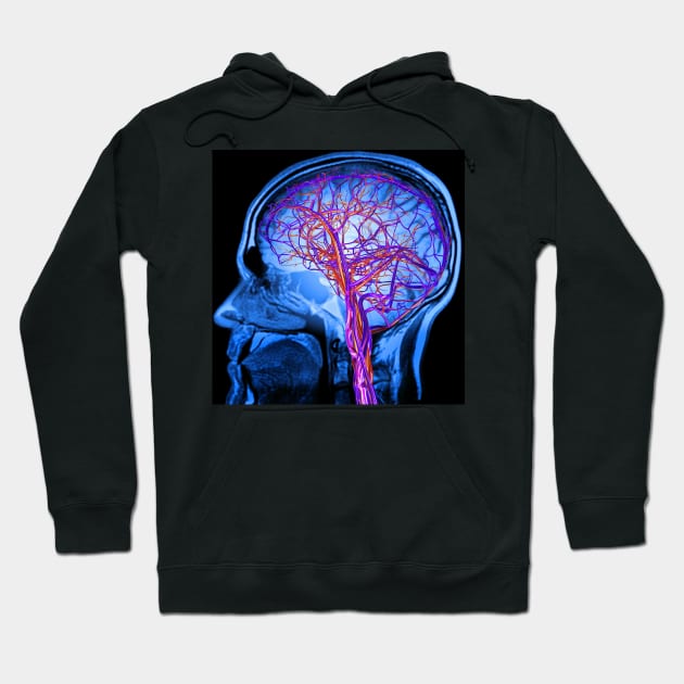 Vascular system of the brain, artwork (C024/6525) Hoodie by SciencePhoto